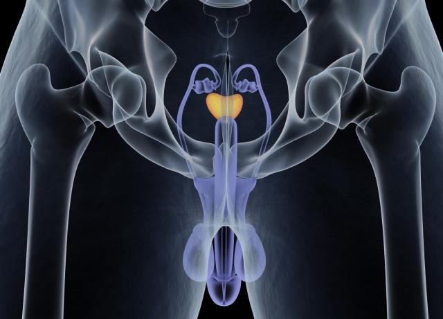 Ovo su najuočljiviji simptomi raka prostate